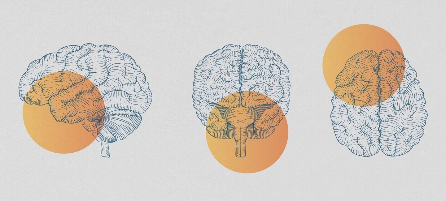 Illustration of three brains surmounted by three orange dots.