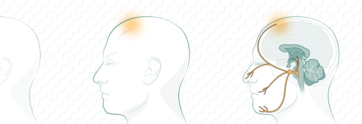 Modern_Understanding_of_the_Pathophysiolog_of_Migraine_1160x400.png